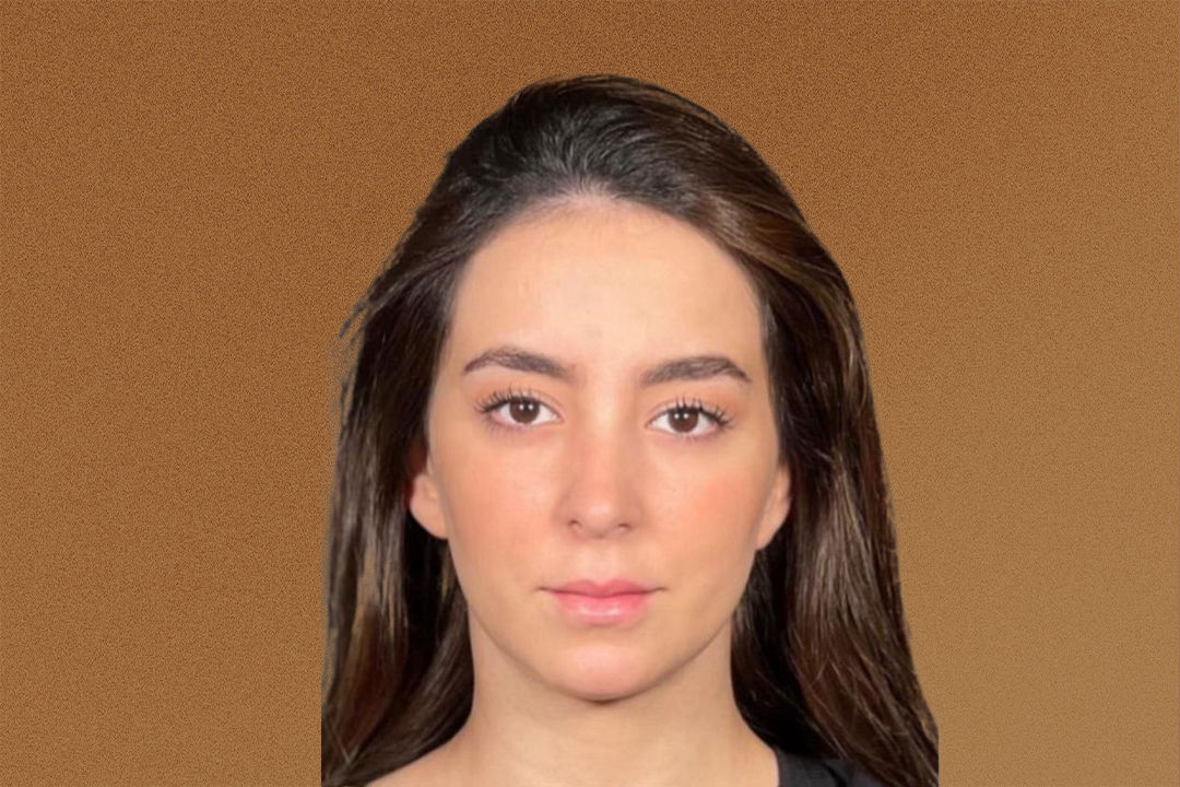 حالة 2 قبل حالة 2 قبل