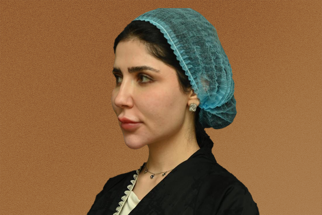 حالة 3 قبل حالة 3 قبل